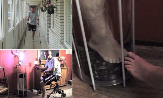 Three images of Leo Bonten's leg lamp, made from his amputated leg.